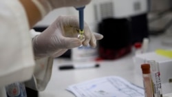 Zika virusiga qarshi vaksina bir-ikki yilda tayyor bo'ladi