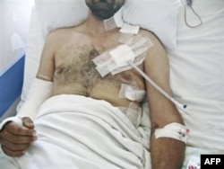 Armiya shimolda hujumga o'tdi, 5 ming suriyalik Turkiyaga qochgan